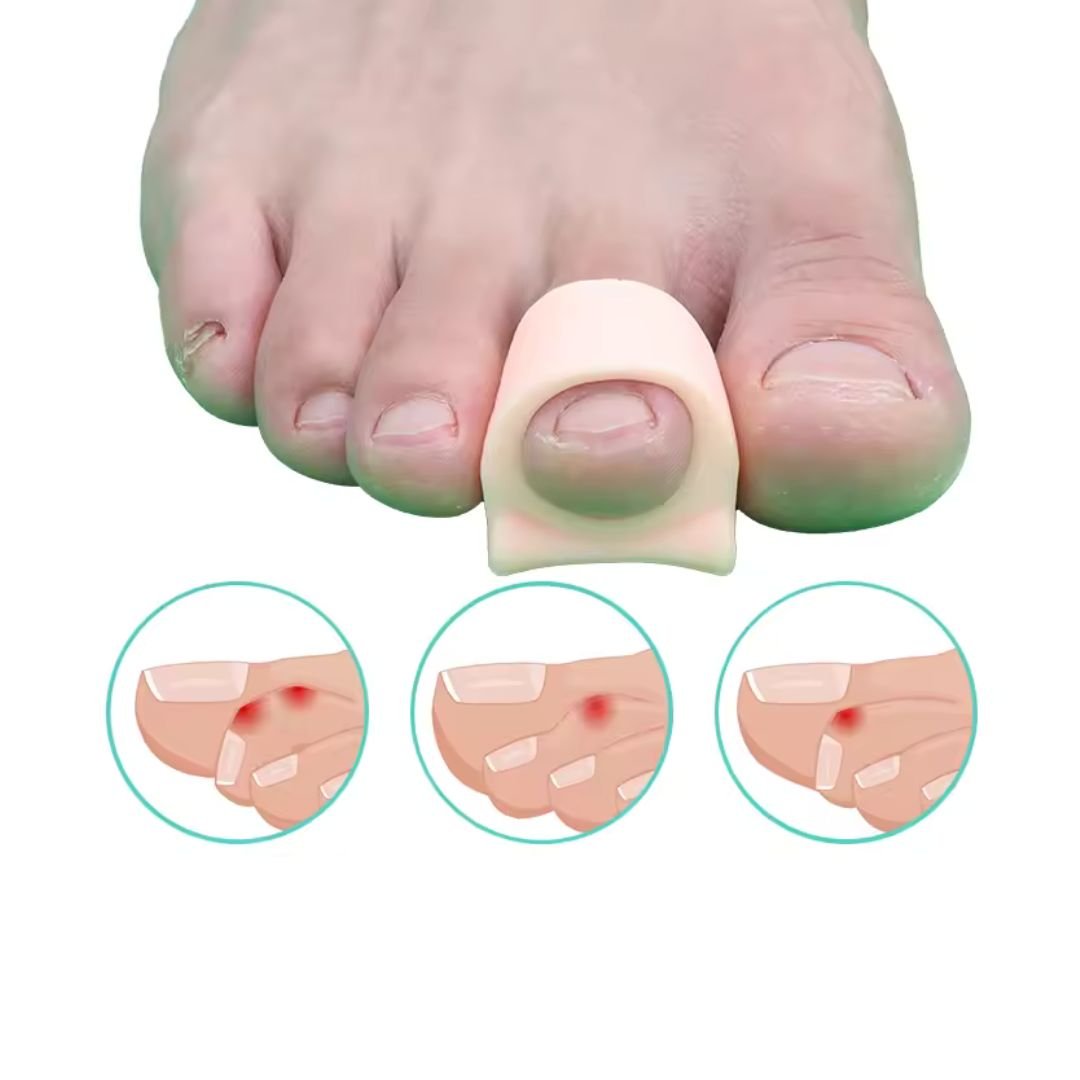 Hammer Toe Support Brace – Toe Straightener Splint