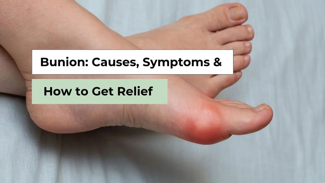 Bunion: Causes, Symptoms & How to Get Relief | Semello
