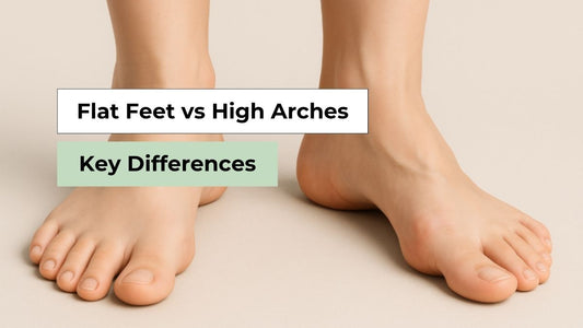 Flat Feet vs High Arches: Key Differences | Semello