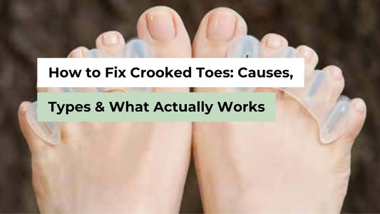 How to Fix Crooked Toes: Causes, Types & What Actually Works