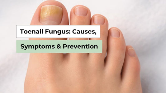 Toenail Fungus: Causes, Symptoms & Prevention 