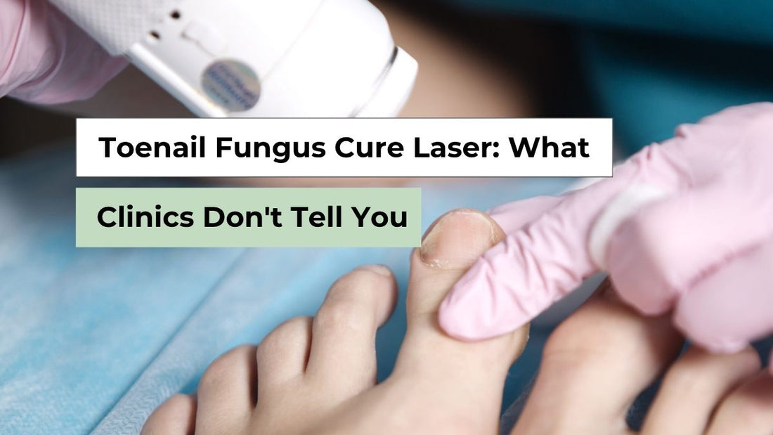 Toenail Fungus Cure Laser: Does It Really Work? | Semello 
