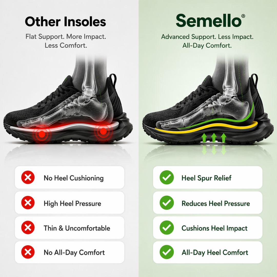 Carbon Fiber Insoles – Arch Support for Running