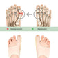 Slim Bunion Splint – Lightweight Toe Brace