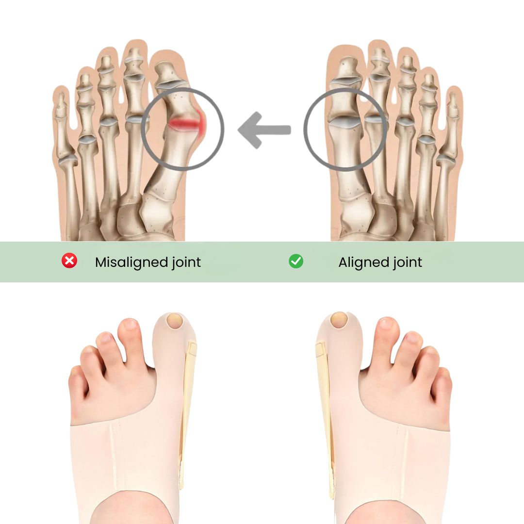 Slim Bunion Splint – Lightweight Toe Brace