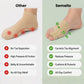 Bunion Relief Socks – Toe Alignment Sleeves