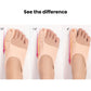 Slim Bunion Splint – Lightweight Toe Brace