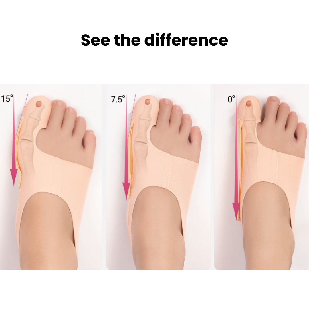Slim Bunion Splint – Lightweight Toe Brace