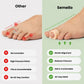 Hammer Toe Support Brace – Toe Straightener Splint