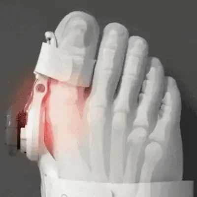 Bunion Corrector Brace – Big Toe Support & Comfort